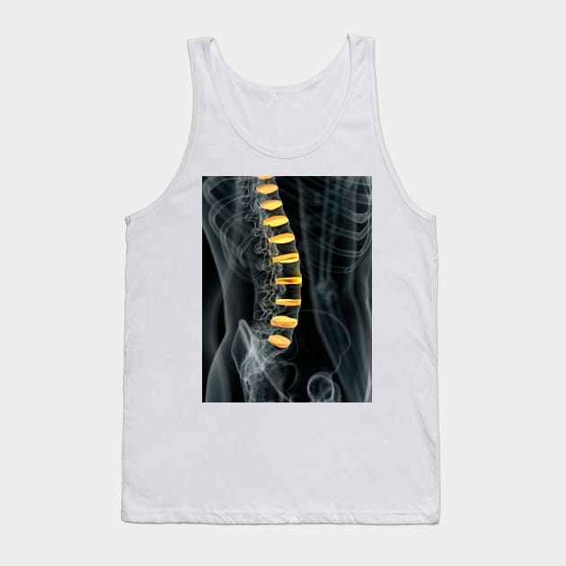 Human spinal intervertebral discs (F011/7098) Tank Top by SciencePhoto